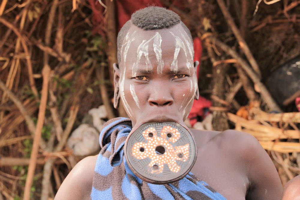 Lipschotel bij Mursivrouw in Ethiopië